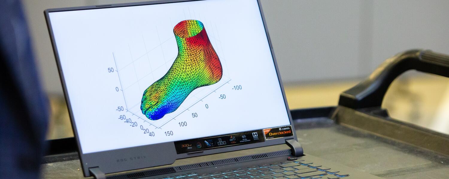 Diagram of foot on laptop